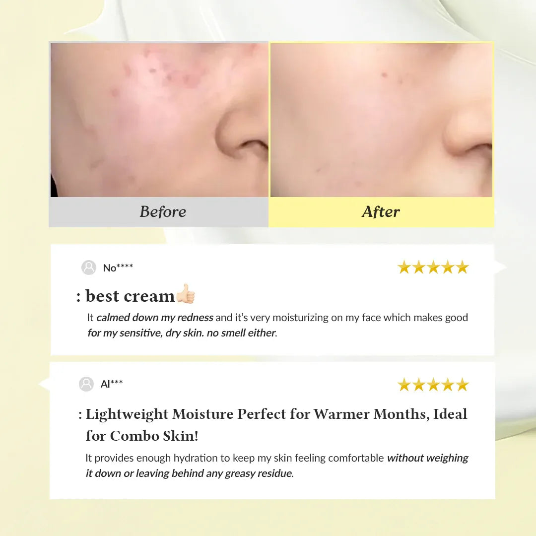 Dr. Althea 345 Relief Cream – Hydration & Skin Relief in One Tube